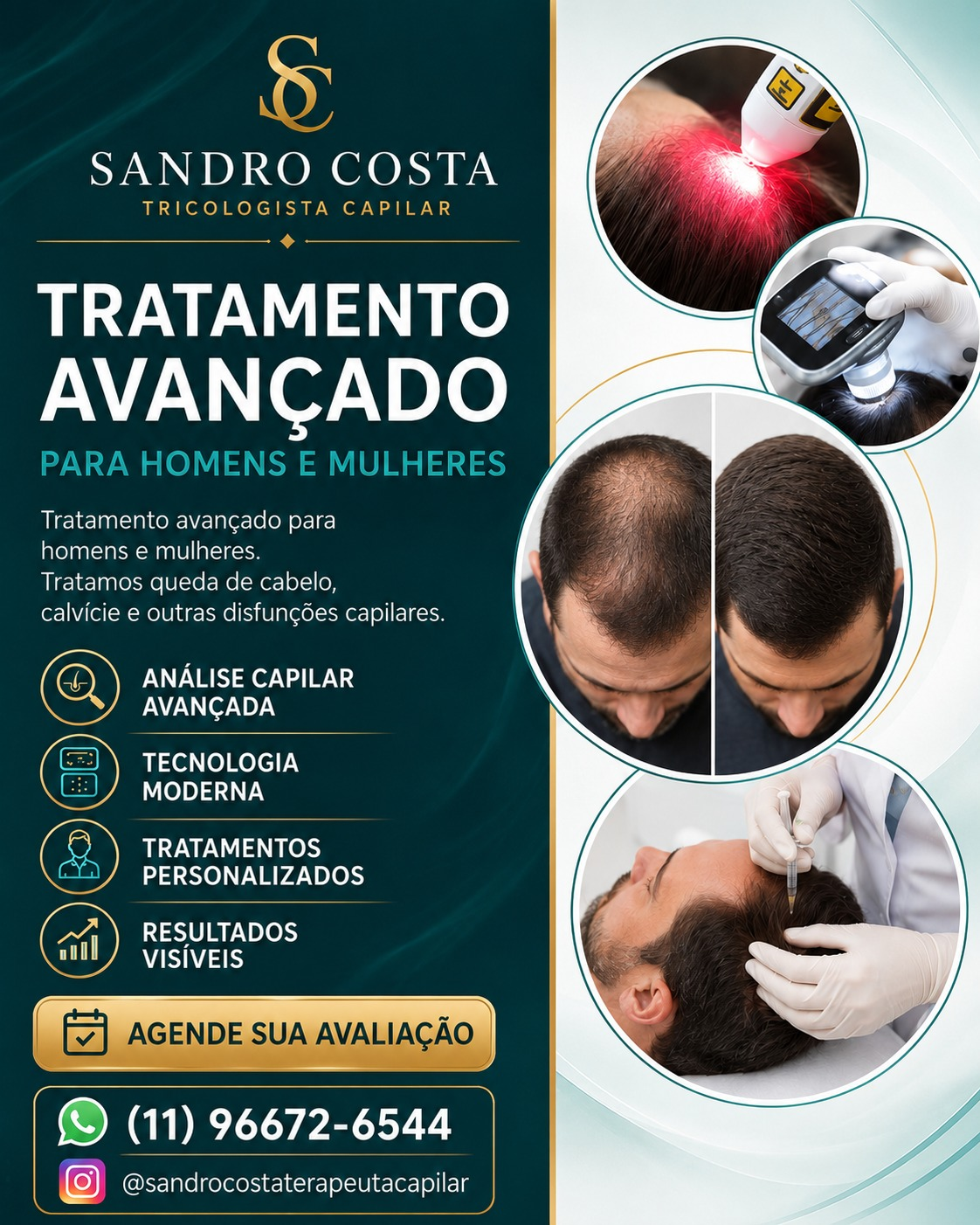 Tratamentos capilares avançados